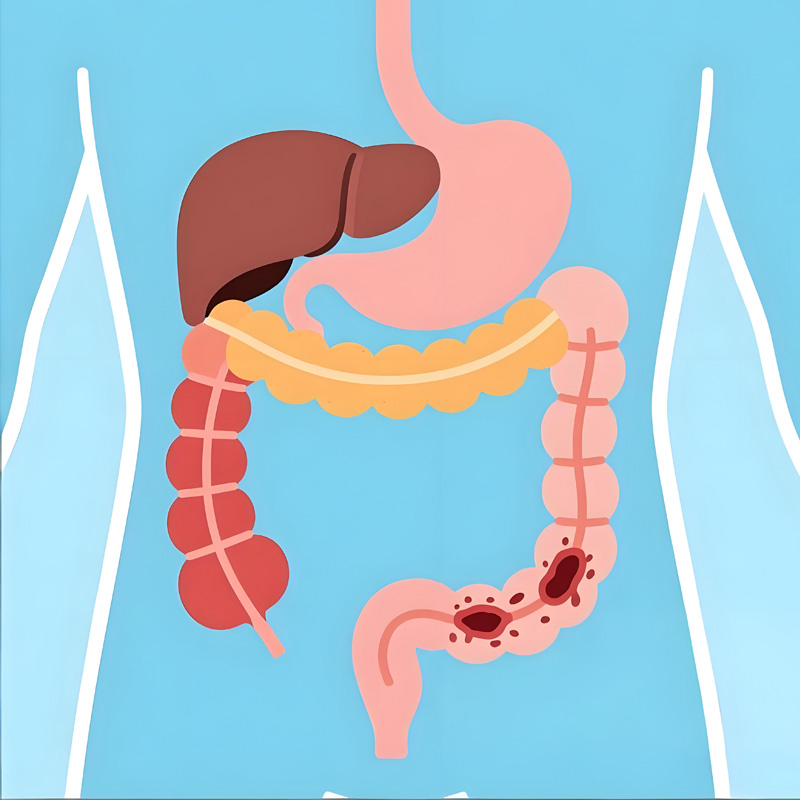 肠癌多半是拖出来的，这些信号很隐蔽!