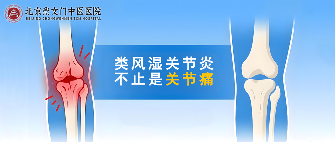深入理解类风湿关节炎，远不止是“关节痛”