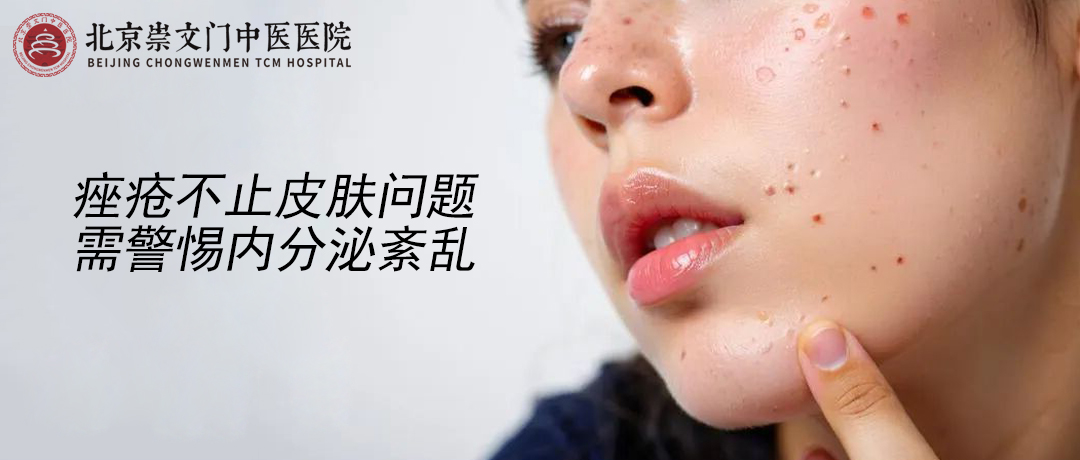 痤疮不只是皮肤问题，背后或藏着内分泌紊乱的信号