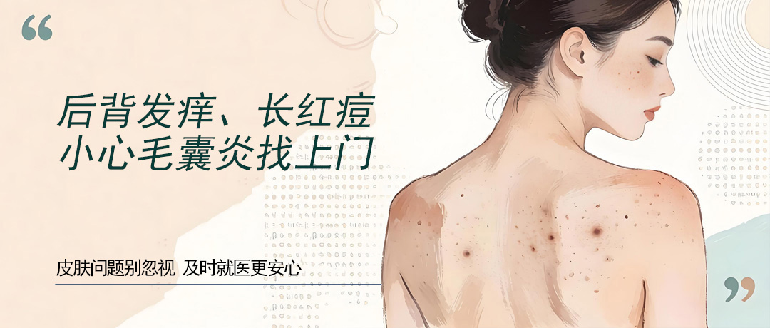 夏季出汗多后背痒、长红痘，小心毛囊炎找上门!