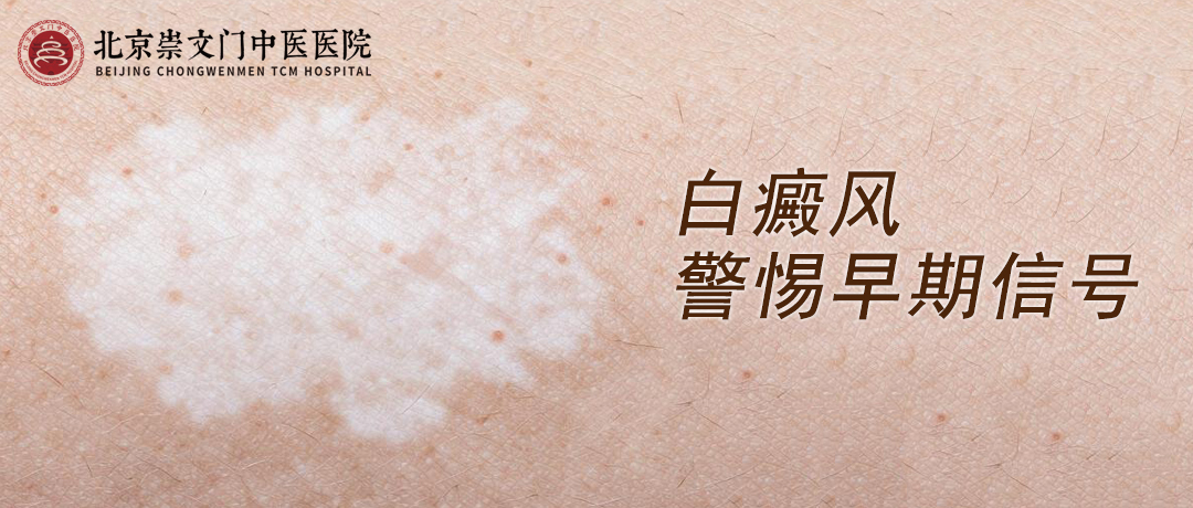 白癜风逐渐扩散，这些早期信号别忽视，早发现早重视