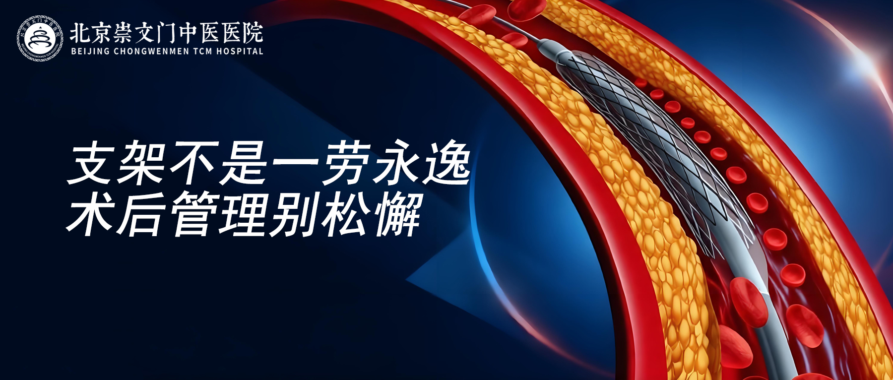 心脏支架术后并非万事大吉，这几件事不注意，支架也白搭